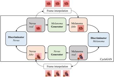 Integrating generative AI with ABCDE rule analysis for enhanced skin cancer diagnosis, dermatologist training and patient education